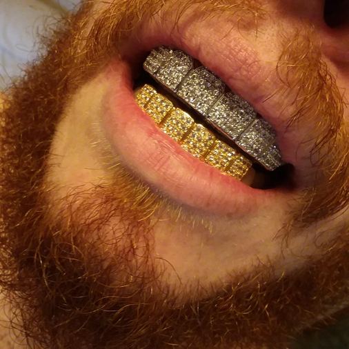 iced out grillz 18K gold plated CZ diamond bling hip hop grillz with extra molding bars